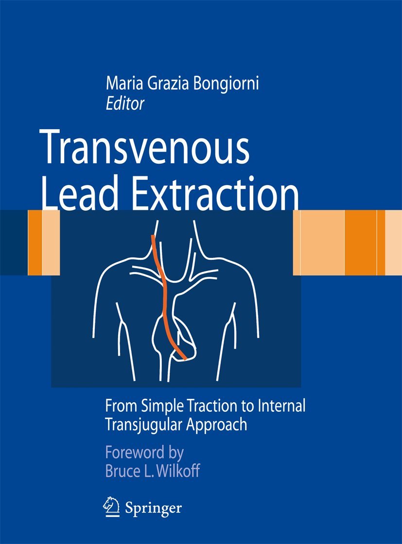 Transvenous Lead Extraction: From Simple Traction to Internal Transjugular Approach [ペーパーバック] Bongiorni， Maria Grazia Amazon | Transvenous Lead Extraction: From Simple Traction